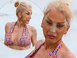 Bikini-clad Big Brother icon Nadia Almada, 49, displays the results of her facelift and gastric sleeve weight loss as she recovers from surgery in Turkey