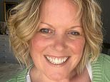 Woman, 54, shows off incredible results after removing ‘blue snake’ varicose vein: ‘It throbbed non-stop, it was agony’