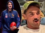 TikTok video of footy star Luke Nankervis goes viral as he’s taken to hospital with a VERY painful medical condition