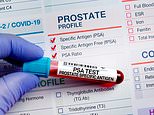 Landmark review confirms that prostate cancer screening DOES save lives