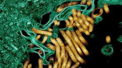 New outbreak of Ebola kills 65 in eastern DR Congo