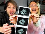 Internet star couple share video explaining that they terminated pregnancy because fetus had Down syndrome… now they’ve received death threats