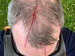 Divebombing buzzard is attacking villagers and knocking cyclists off their bikes – as petrified parents BAN their children from walking down path where the bird of prey swoops