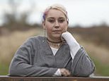 The horror of discovering hat an NHS doctor has left a surgical item inside your body… MONTHS later