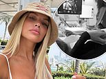 Love Island’s Hayley Hughes reveals she’s expecting second child with mystery partner six months after getting engaged