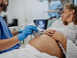Pregnant women should limit their sugar intake to protect their children’s mental health, experts warn