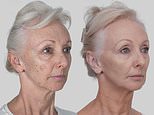 Debbie McGee, 67, reveals the results of her ‘life-changing’ non-surgical facelift as she says ‘I look better than I did in my 40s’