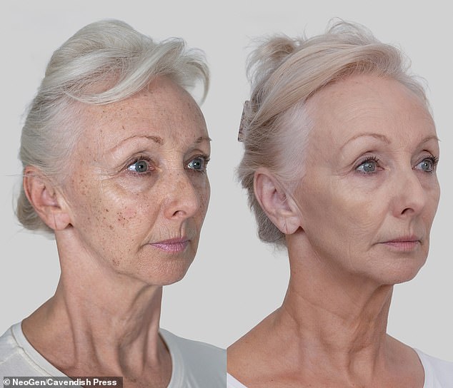 'I don't wear make-up anymore': Debbie McGee, 67, has revealed the results of her 'life-changing' non-surgical facelift as she said: 'I look better than I did in my 40s', (Pictured right after the treatment'