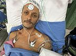 British man left with leg ‘dangling off’ after Thailand motorbike crash – and now facing £22,000 hospital bills