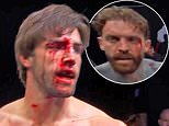 Love Island’s Jack Fincham is left covered in blood as doctors are forced to stop bare knuckle fight with Geordie Shore’s Aaron Chalmers in minutes
